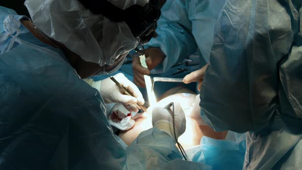 Doctors are Performing Surgery at the Hospital