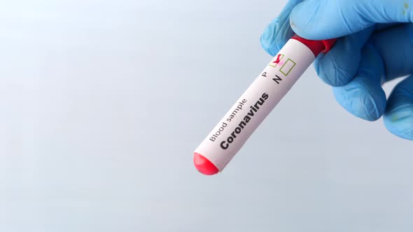 Laboratory Technician Hand Holding Blood Test Tube with Copy Space 