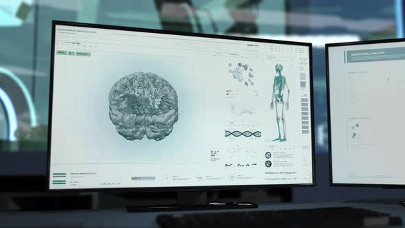 Advanced Computer Ct Scanning Software At Diagnostic Oncological Laboratory