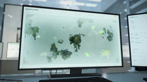 Infusoria Slippers Microorganism Study Via Modern Microscopic Interface alt