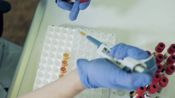 Biological Fluids Are Being Poured Into Test Tubes. Coronavirus, Covid-19 Laboratory Test.