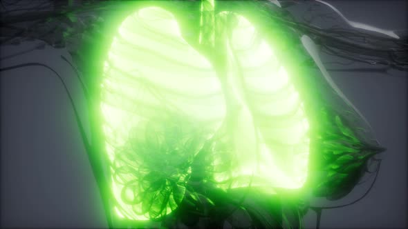 Human Lungs Radiology Exam alt