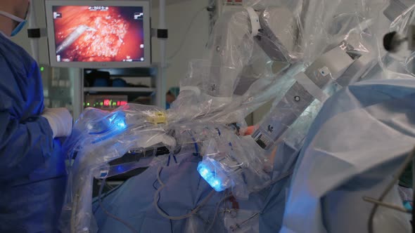 Minimally Invasive Robotic Surgery using advanced technology in a hospital