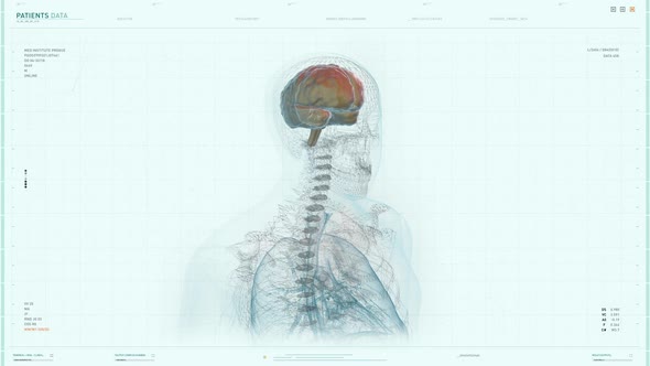 Futuristic High Tech Program Patient Head Scanner Brain Medical Analysis alt