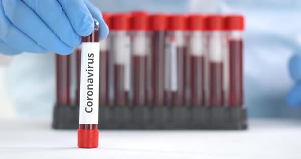 Coronavirus Test and Bottle with Ritonavir Generic Pills