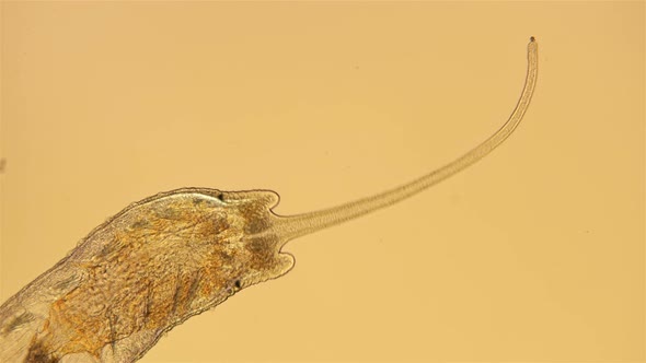 Worm of the Family Naididae Under a Microscope