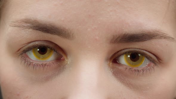 Closeup of a Browneyed Young Woman Wearing Yellow Decorative Lenses Opening Eyes and Closing