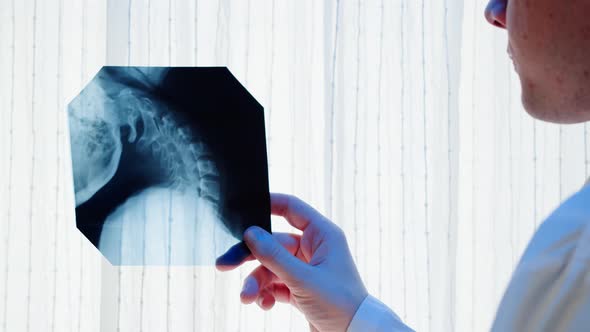 Doctor Examining Neck Xray Closeup