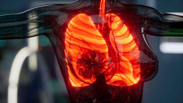 Human Lungs Radiology Exam in Laboratory alt