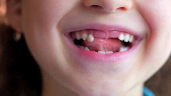  Little Girl's smile, Baby Teeth. Child Touches With His Tongue Baby Tooth. 