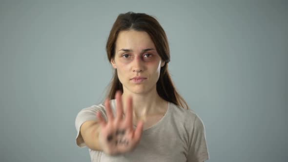 Bruised Woman With Me Too Sign on Hand, Movement Against Sexual Harassment