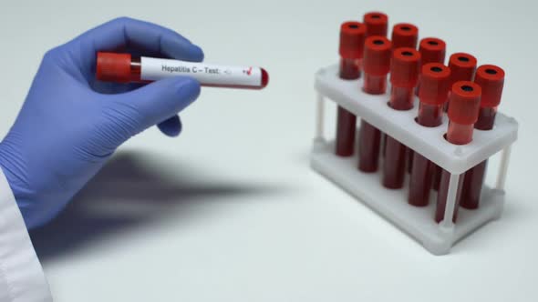 Positive Hepatitis C Test, Doctor Showing Blood Sample in Tube, Health Checkup