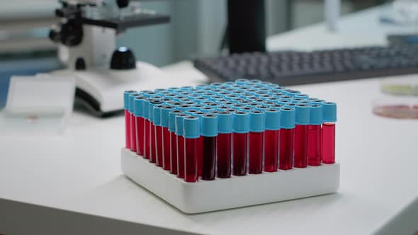 Close Up of Vacutainers with Liquid Blood in Laboratory