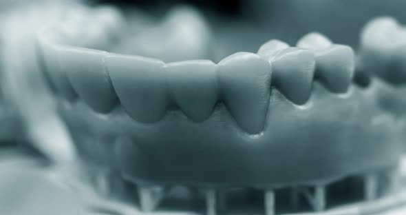 The Lower Jaw Man Created on a 3d Printer From a Photopolymer