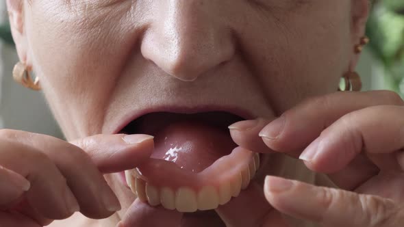 Woman with false teeth, close up. Dental concept. Mouth of female pulls upper jaw out