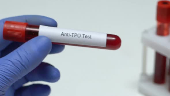 Anti-Tpo Test, Doctor Holding Blood Sample in Tube Close-Up, Health Check-Up