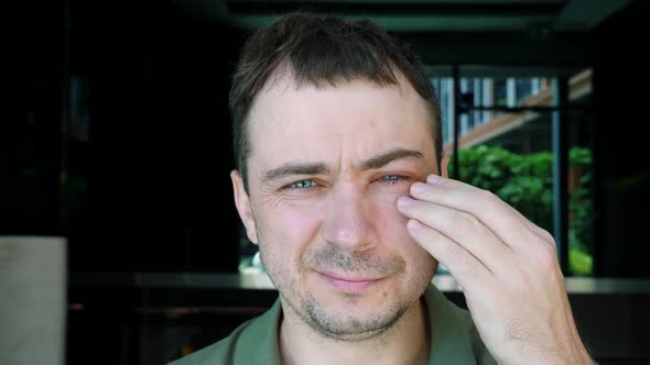 Sad Man Touch By Hand One Swollen Infected Eye Feeling Pain Conjunctivitis