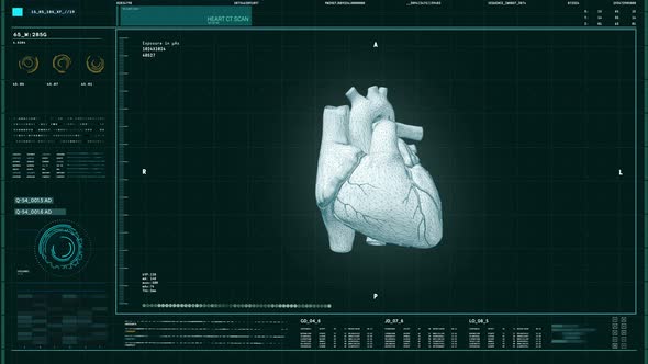 Scanning Human Heart Disease In Interface Of Futuristic Health Care Technology alt