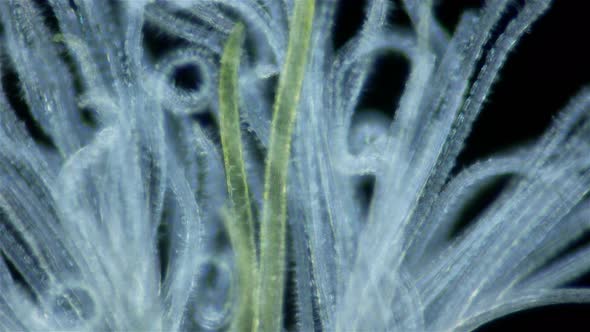 Polychaeta Worm Order Sabellida Under a Microscope