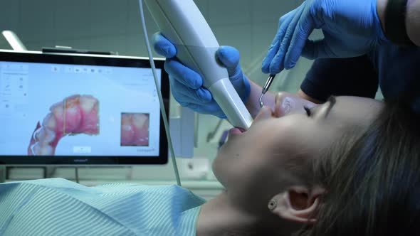 Doctor Scans the Patient's Teeth in the Clinic