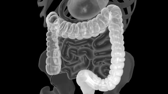 Colonoscopy is the visualization of the large intestine with a tube called a colonoscope.
