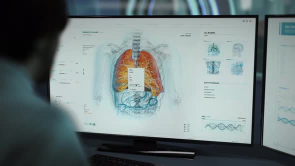 Supervising the Medical Research of Human Lungs for the covid 19 virus pandemic alt