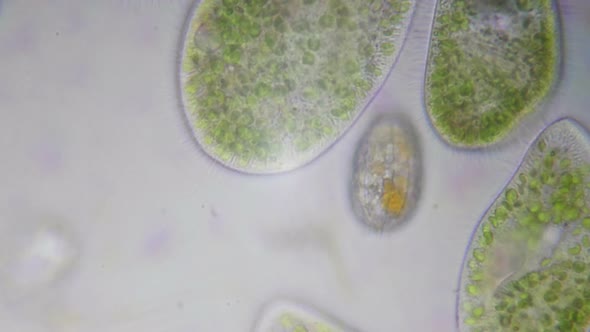 Paramecium Bursaria Protozoan Under The Microscope