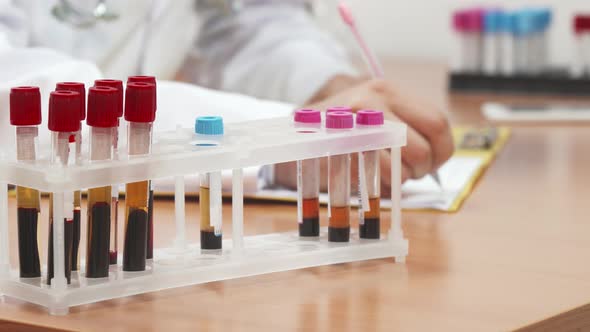 The Blood Test Tubes for Medical Tests