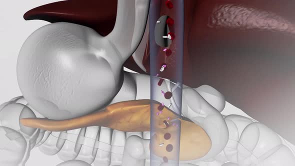 glucose and insulin molecules in the blood.