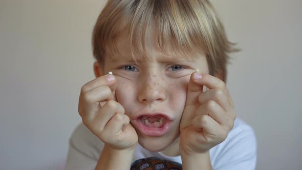 Little Boy Shows That Some of His Milk Teeth Had Fallen Out. Concept of Tooth Change in Children