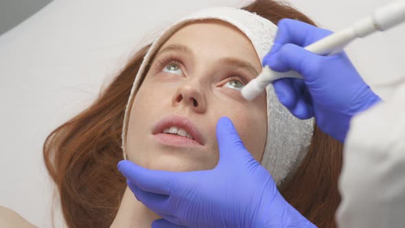 Closeup of Female Face During the Procedure of Skin Rejuvenation.