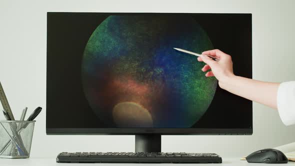 Doctor Veterinarian Examining Horse Eye Cornea on Computer Monitor