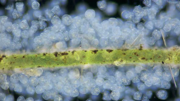 Infusoria Ciliophora Vorticella Under Microscope Class Oligohymenophorea