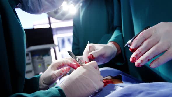 Surgeons performing operation in operation room