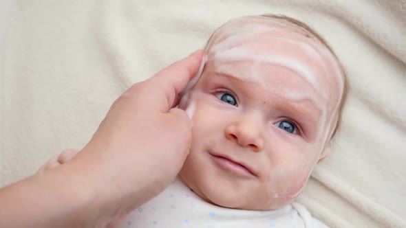 Applying Curing Lotion or Ointment on Baby Cheecks Suffering From Dermatitis and Acne