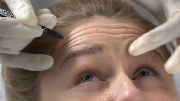 Cosmetologist Marking Forehead Wrinkles Before Filler Injection, Skin Perfection