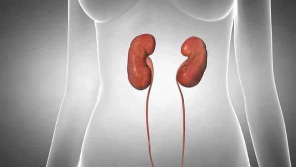 journey of kidney stone in human body