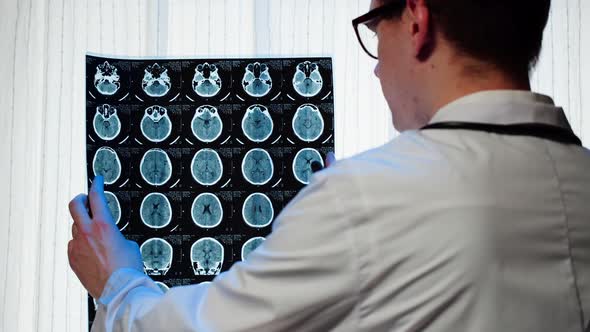 Doctor Examining Xray Magnetic Resonance Image of Head