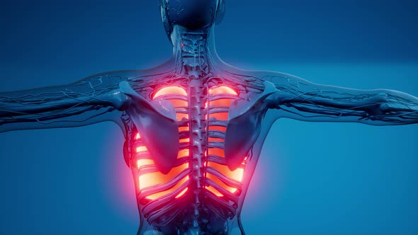 Human Lungs Radiology Exam alt