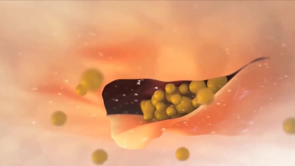 Animation of torn skin plaque