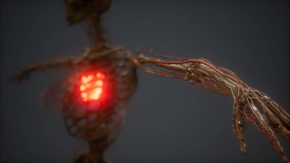 CG Animation Of A Sick Human Heart