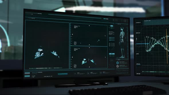 Medical scanner is studying the Covid-19 Pneumonia virus damage for therapy alt