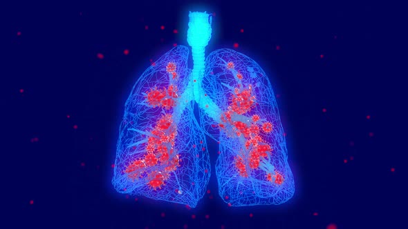 Covid 19 affecting the Human Lungs