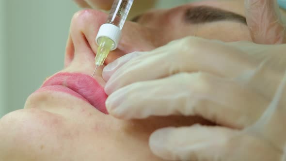 The Cosmetologist Makes Injections on the Client's Face in the Lip Area