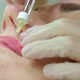 The Cosmetologist Makes Injections on the Client's Face in the Lip Area - VideoHive Item for Sale