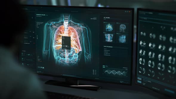 Identifying the cancerous cells after the x-ray examination of the lungs alt