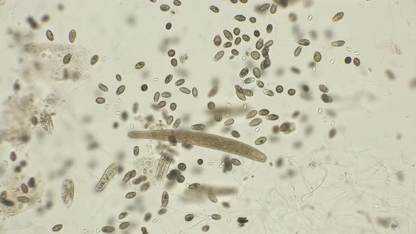 Accelerated Movement of a Large Colony of Ciliates of the Ciliates, Which Are Largely in Dirty