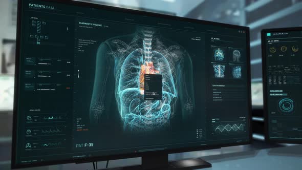 Identifying the Cardiac Ischemia disease after the medical heart examination alt