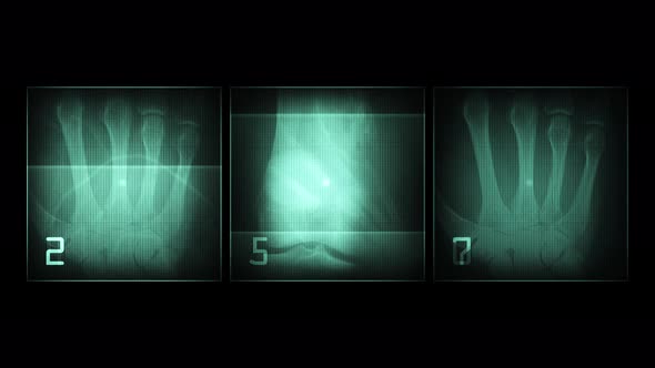 Hud Ui Element Xray Scan alt