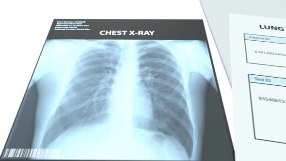 The Radiologist Exam the X-rays Images and Makes a Medical Conclusion